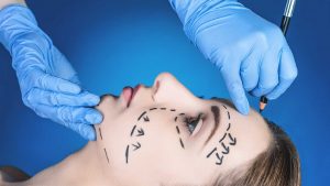 Everything You Should Know Before Deciding To Do A Plastic Surgery